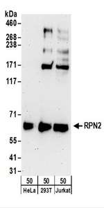 Detection of Human RPN2 by Western Blot. Samples: Whole cell lysate (50 ug) from HeLa, 293T, and Jurkat cells. Antibodies: Affinity purified rabbit anti-RPN2 antibody used for WB at 0.4 ug/ml. Detection: Chemiluminescence with an exposure time of 3 minutes.