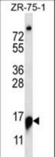 RPP25 Antibody western blot of ZR-75-1 cell line lysates (35 ug/lane). The RPP25 antibody detected the RPP25 protein (arrow).