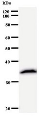 Western blot of immunized recombinant protein using RPP30 antibody.