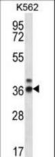 RPP38 Antibody western blot of K562 cell line lysates (35 ug/lane). The RPP38 antibody detected the RPP38 protein (arrow).