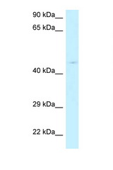 RPP40 antibody LS-C145820 Western blot of HeLa Cell lysate. Antibody concentration 1 ug/ml.