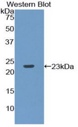 Western blot of recombinant RPP40.