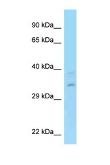 RPRD1A antibody LS-C146233 Western blot of Fetal Lung lysate. Antibody concentration 1 ug/ml.