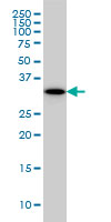 P15RS monoclonal antibody (M01), clone 1B8 Western blot of P15RS expression in A-431.