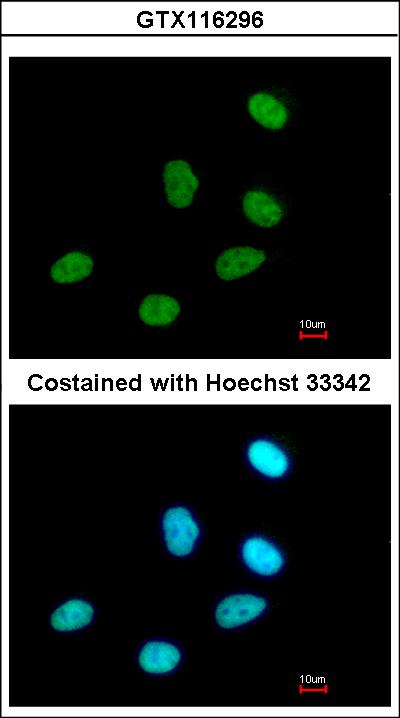 Immunofluorescence of paraformaldehyde-fixed A549, using P15RS antibody at 1:500 dilution.