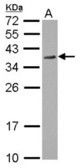 Sample (30 ug of whole cell lysate) A: HCT116 12% SDS PAGE RPRD1A antibody diluted at 1:1000