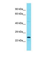 Western blot of Mouse Testis. Rprd1b antibody dilution 1.0 ug/ml.