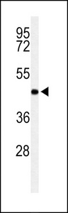 Western blot of RPR1B Antibody in Jurkat cell line lysates (35 ug/lane). RPR1B (arrow) was detected using the purified antibody.