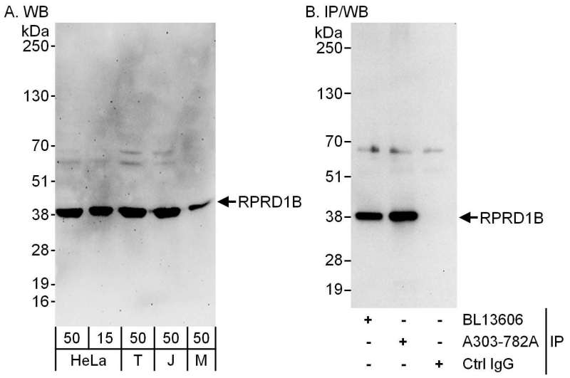 Detection of Human and Mouse RPRD1B by Western Blot (h and m) and Immunoprecipitation (h). Samples: Whole cell lysate from HeLa (15 and 50 ug for WB; 1 mg for IP, 20% of IP loaded), 293T (T; 50 ug), Jurkat (J; 50 ug) and mouse NIH3T3 (M; 50 ug) cells. Antibodies: Affinity purified rabbit anti-RPRD1B antibody used for WB at 0.1 ug/ml (A) and 1 ug/ml (B) and used for IP at 6 ug/mg lysate. RPRD1B was also immunoprecipitated by rabbit anti-RPRD1B antibody BL13606, which recognizes an upstream epitope. Detection: Chemiluminescence with exposure times of 3 minutes (A) and 10 seconds (B).