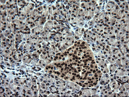 IHC of paraffin-embedded Human pancreas tissue using anti-RPRD1B mouse monoclonal antibody. (Heat-induced epitope retrieval by 1 mM EDTA in 10mM Tris, pH8.5, 120°C for 3min).