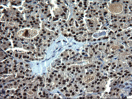 IHC of paraffin-embedded Human thyroid tissue using anti-RPRD1B mouse monoclonal antibody. (Heat-induced epitope retrieval by 1 mM EDTA in 10mM Tris, pH8.5, 120°C for 3min).