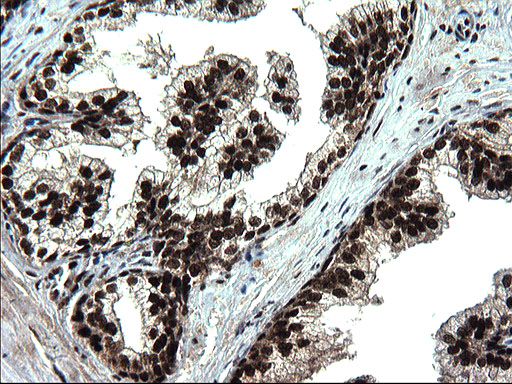 IHC of paraffin-embedded Human prostate tissue using anti-RPRD1B mouse monoclonal antibody. (Heat-induced epitope retrieval by 1 mM EDTA in 10mM Tris, pH8.5, 120°C for 3min).