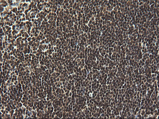 IHC of paraffin-embedded Human lymph node tissue using anti-RPRD1B mouse monoclonal antibody. (Heat-induced epitope retrieval by 1 mM EDTA in 10mM Tris, pH8.5, 120°C for 3min).