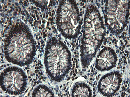 IHC of paraffin-embedded Human colon tissue using anti-RPRD1B mouse monoclonal antibody. (Heat-induced epitope retrieval by 1 mM EDTA in 10mM Tris, pH8.5, 120°C for 3min).
