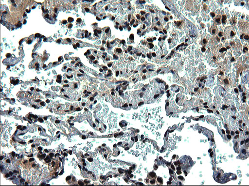 IHC of paraffin-embedded Human lung tissue using anti-RPRD1B mouse monoclonal antibody. (Heat-induced epitope retrieval by 1 mM EDTA in 10mM Tris, pH8.5, 120°C for 3min).