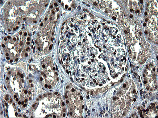 IHC of paraffin-embedded Human Kidney tissue using anti-RPRD1B mouse monoclonal antibody. (Heat-induced epitope retrieval by 1 mM EDTA in 10mM Tris, pH8.5, 120°C for 3min).