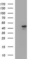 HEK293T cells were transfected with the pCMV6-ENTRY control (Left lane) or pCMV6-ENTRY RPRD1B (Right lane) cDNA for 48 hrs and lysed. Equivalent amounts of cell lysates (5 ug per lane) were separated by SDS-PAGE and immunoblotted with anti-RPRD1B.