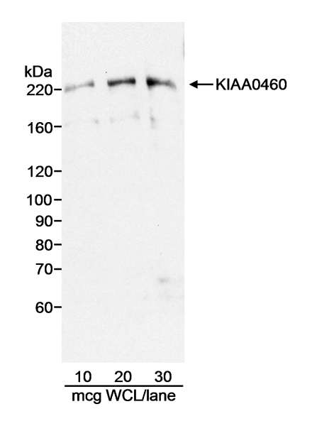 Detection of Human KIAA0460 by Western Blot. Samples: Whole cell lysate (WCL; amounts indicated) from HeLa cells. Antibody: Affinity purified goat anti-KIAA0460 antibody used at 1 ug/ml. Detection: Chemiluminescence with 3 minute exposure.