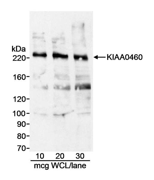 Detection of Human KIAA0460 by Western Blot. Samples: Whole cell lysate (WCL; amounts indicated) from HeLa cells. Antibody: Affinity purified goat anti-KIAA0460 antibody used at 1 ug/ml. Detection: Chemiluminescence with 3 minute exposure.