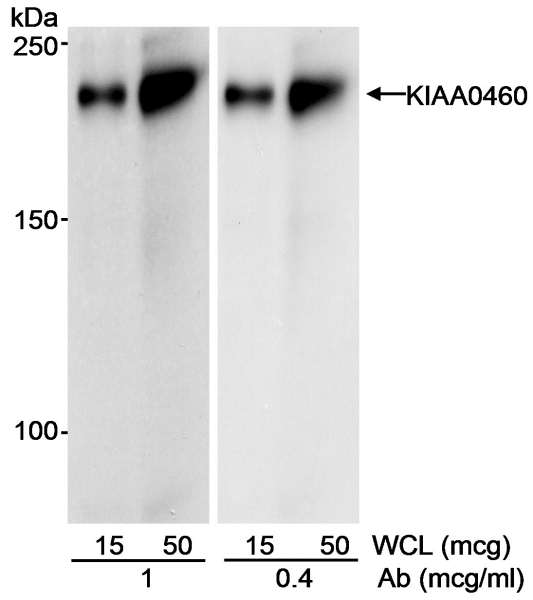 Detection of Human KIAA0460 by Western Blot. Samples: Whole cell lysate (15 and 50 ug) from HEK293 cells. Antibody: Affinity purified goat anti-KIAA0460 antibody used at 1 and 0.4 ug/ml. Detection: Chemiluminescence with an exposure time of 1 minute.