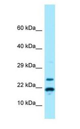 RPS11 antibody Western Blot of MCF7.