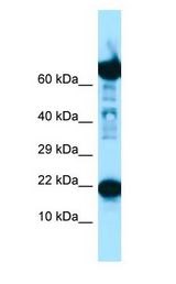 RPS11 antibody Western Blot of Fetal Lung.