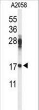 Western blot of RPS11 Antibody in A2058 cell line lysates (35 ug/lane). RPS11 (arrow) was detected using the purified antibody.