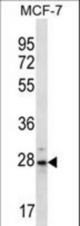 PSMB10 Antibody western blot of MCF-7 cell line lysates (35 ug/lane). The PSMB10 antibody detected the PSMB10 protein (arrow).