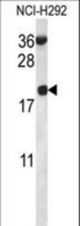 RPS12 Antibody western blot of NCI-H292 cell line lysates (35 ug/lane). The RPS12 antibody detected the RPS12 protein (arrow).