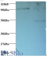 Western blot of 40S ribosomal protein S12 antibody at 2 ug/ml. Lane 1: EC109 whole cell lysate. Lane 2: 293T whole cell lysate. Secondary: Goat polyclonal to Rabbit IgG at 1:15000 dilution. Predicted band size: 14.5 kDa. Observed band size: 90 kDa Additional bands at: 50 kDa. We are unsure as to the identity of this extra band.