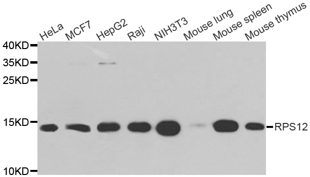 Western blot analysis of extracts of various cell lines, using RPS12 antibody.