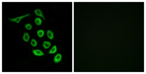 Immunofluorescence of A549 cells, using RPS12 Antibody. The picture on the right is treated with the synthesized peptide.