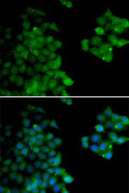 Immunofluorescence blot of HeLa cell using PSMB10 antibody. Blue: DAPI for nuclear staining.