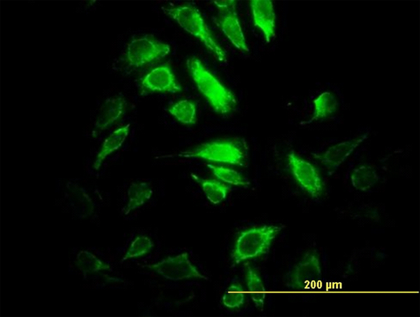 Immunofluorescence of monoclonal antibody to PSMB10 on HeLa cell. [antibody concentration 10 ug/ml]