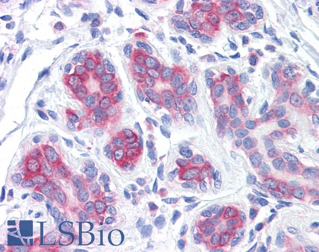 Anti-RPS2 antibody IHC of human breast. Immunohistochemistry of formalin-fixed, paraffin-embedded tissue after heat-induced antigen retrieval. Antibody LS-B4404 concentration 5 ug/ml.