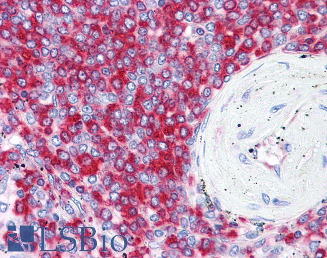 Anti-RPS2 antibody IHC of human spleen. Immunohistochemistry of formalin-fixed, paraffin-embedded tissue after heat-induced antigen retrieval. Antibody LS-B4404 concentration 5 ug/ml.