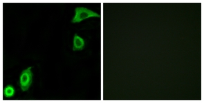 Immunofluorescence of A549 cells, using RPS20 Antibody. The picture on the right is treated with the synthesized peptide.