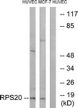 Western blot of extracts from HUVEC/MCF-7 cells, using RPS20 Antibody. The lane on the right is treated with the synthesized peptide.