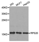 Western blot analysis of extracts of various cell lines, using RPS20 antibody.