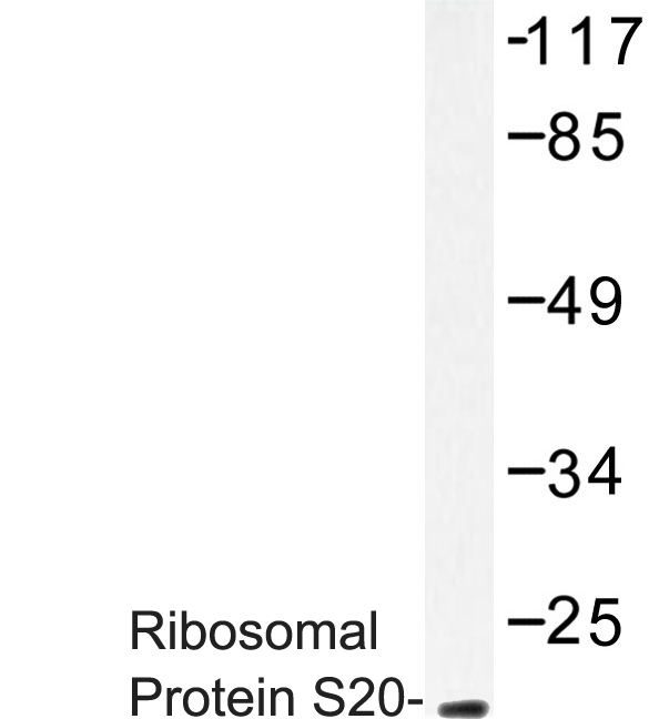 Western blot of Ribosomal Protein S20 (K67) pAb in extracts from HUVEC cells.