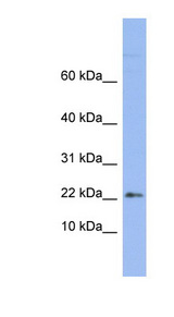 RPS24 antibody LS-C110503 Western blot of OVCAR-3 cell lysate.