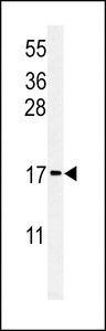 Western blot of RPS24 Antibody in MCF-7 cell line lysates (35 ug/lane). RPS24 (arrow) was detected using the purified antibody.