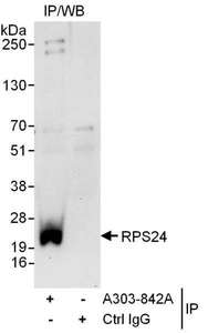 Detection of Human RPS24 by Western Blot of Immunoprecipitates. Samples: Whole cell lysate (1 mg for IP; 20% of IP loaded) from 293T cells. Antibodies: Affinity purified rabbit anti-RPS24 antibody used for IP at 6 ug/mg lysate. For blotting immunoprecipitated RPS24, was used at 0.4 ug/ml. Detection: Chemiluminescence with an exposure time of 30 seconds.