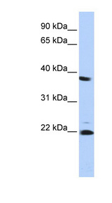PSMB2 antibody LS-C102704 Western blot of HepG2 cell lysate.
