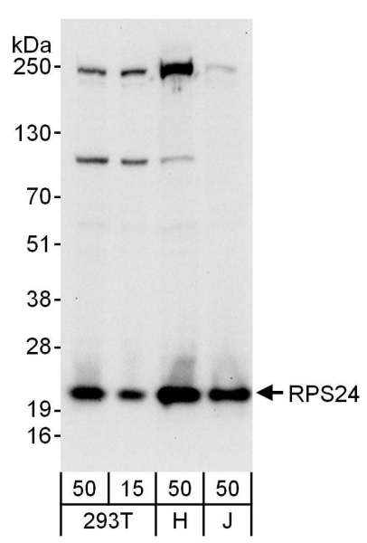 Detection of Human RPS24 by Western Blot. Samples: Whole cell lysate from 293T (15 and 50 ug), HeLa (H; 50 ug), and Jurkat (J; 50 ug) cells. Antibodies: Affinity purified rabbit anti-RPS24 antibody used for WB at 0.1 ug/ml. Detection: Chemiluminescence with an exposure time of 10 seconds.