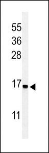 Western blot of RPS25 Antibody in Jurkat cell line lysates (35 ug/lane). RPS25 (arrow) was detected using the purified antibody.