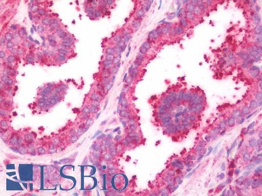 Anti-RPS25 / S25 antibody IHC staining of human prostate. Immunohistochemistry of formalin-fixed, paraffin-embedded tissue after heat-induced antigen retrieval. Antibody LS-B10649 concentration 10 ug/ml.