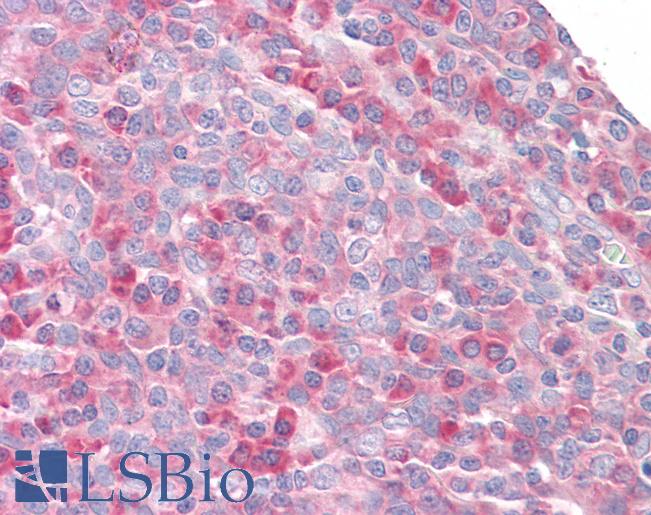 Anti-RPS27 / MPS1 antibody IHC staining of human tonsil. Immunohistochemistry of formalin-fixed, paraffin-embedded tissue after heat-induced antigen retrieval.