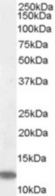 Antibody (0.05 ug/ml) staining of Jurkat lysate (35 ug protein in RIPA buffer). Primary incubation was 1 hour. Detected by chemiluminescence.