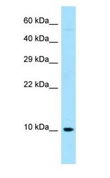 RPS27 / MPS1 antibody Western Blot of Fetal Liver.
